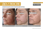 EVIPRO ANTI-AGE HYDRO-LIPID SYSTEM Омолаживающий комплекс (сыворотка 30мл, крем 30мл)