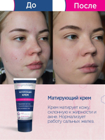 Матирующий крем Noproblem - 50 мл.