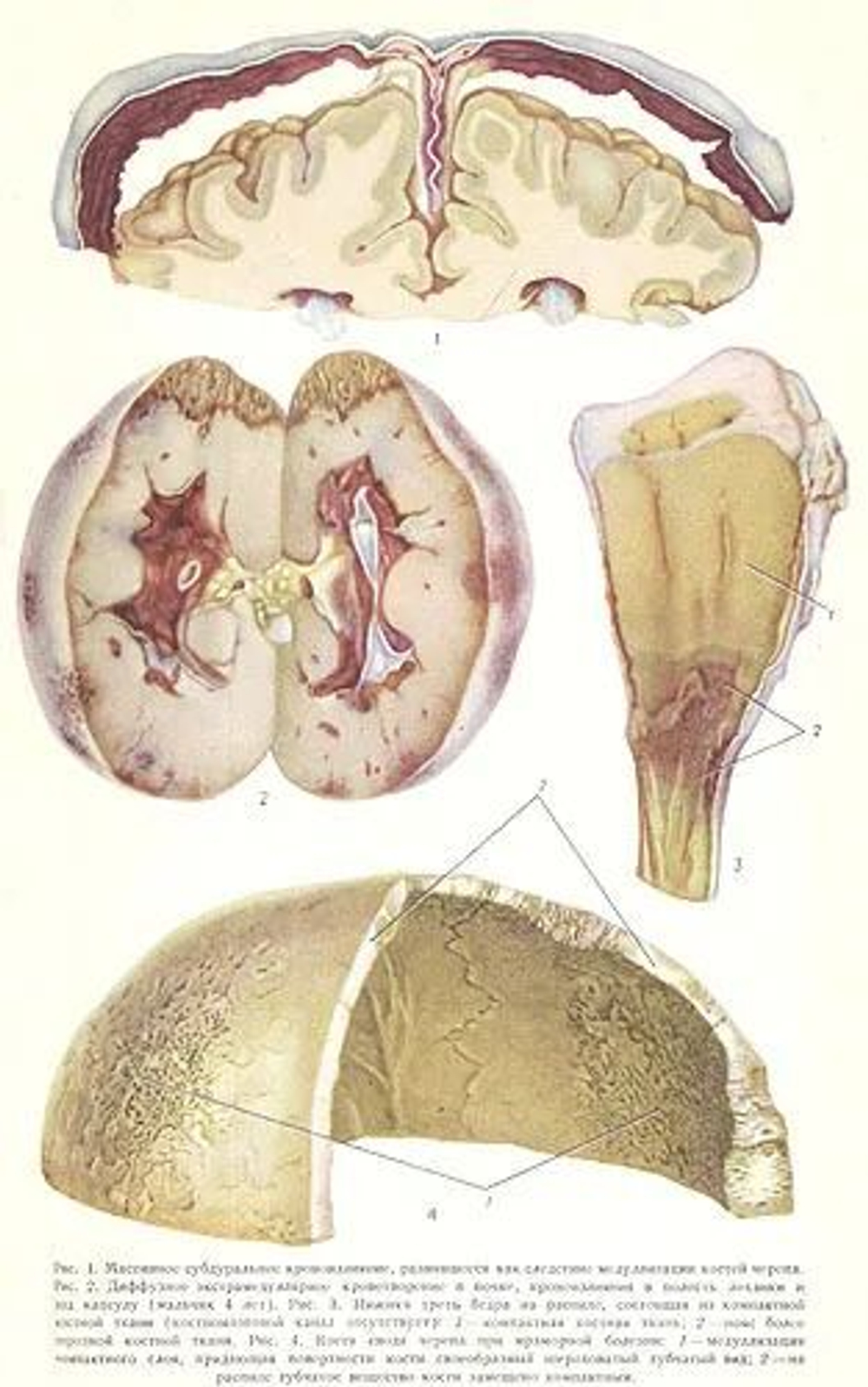 Большая медицинская энциклопедия. В 35-ти томах + дополнительный том (комплект из 36-ти книг)