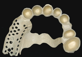 Разговоры о низкой ремонтопригодности протезов