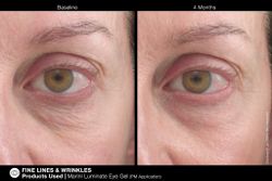 JAN MARINI LUMINATE EYE GEL Концентрированная сыворотка для кожи вокруг глаз с эффектом сияния против темных кругов и морщин