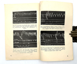 Гедеванишвили Д. М. (АВТОГРАФ) .О парной и раздельной работе больших полушарий головного мозга.1956г