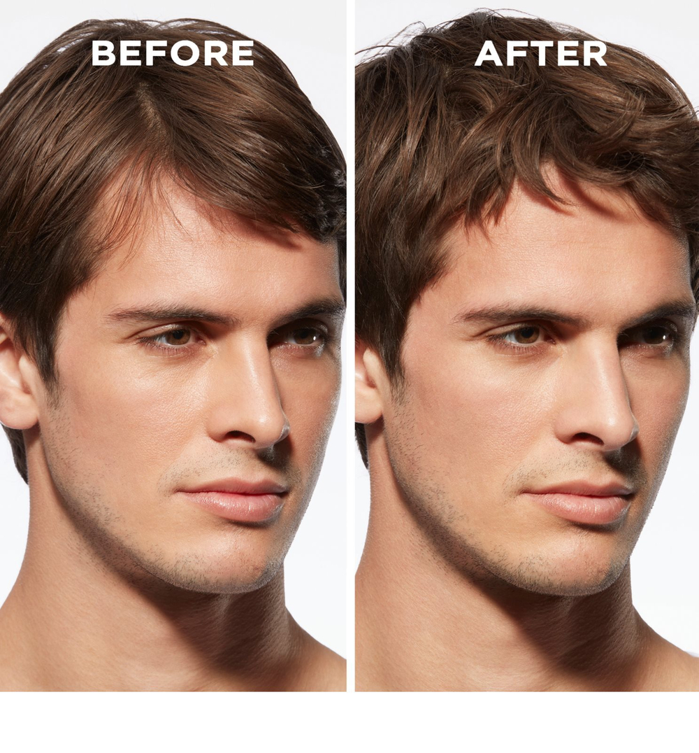 Kerastase Genesis Homme Serum Anti-chute Fortifiant - укрепляющая сыворотка для ослабленных волос со склонностью к выпадению /  dla mężczyzn 90  ml  / GTIN 3474637077495