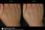 JAN MARINI RENU CORRECTIVE HAND COMPLEX Антивозрастной корректирующий крем для рук
