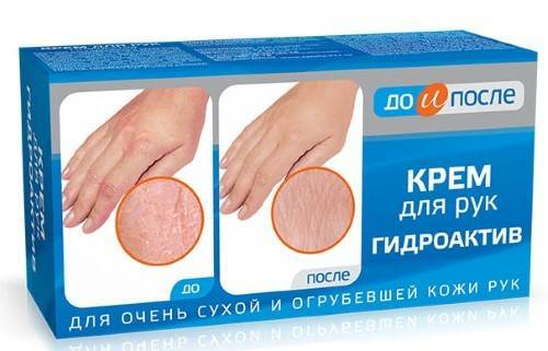 До и После Крем для рук «Гидроактив», 100 мл