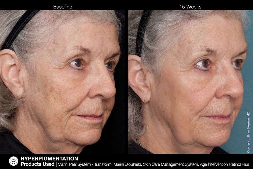 JAN MARINI AGE INTERVENTION RETINOL+ 0,5% Крем-акселератор с ретинолом 0,5% для борьбы с видимыми возрастными изменениями