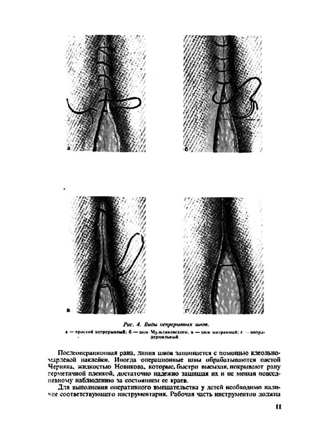 Оперативная хирургия с топографической анатомией детского возраста | Ю.Ф. Исаков; Ю.М. Лопухин