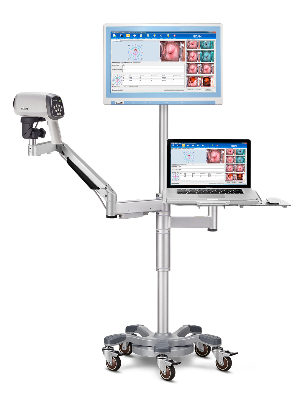 Видеокольпоскоп Edan C6 и Edan C6A