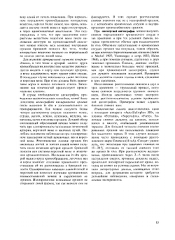 Рентгеновская анатомия сосудистой системы | Д. Лужа