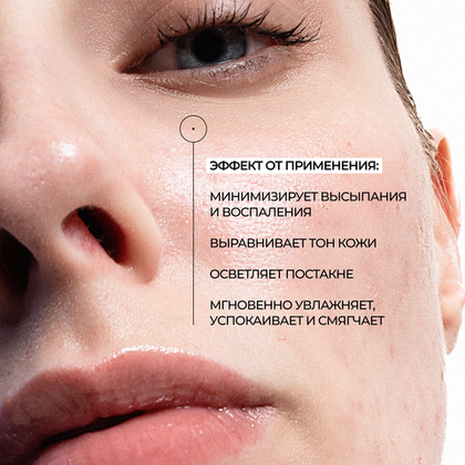 СОЮЗНИКИ КОЖИ Сыворотка с азелаиновой и койевой кислотами / ALLIES OF SKIN Azelaic & Kojic Advanced Clarifying Serum, 50 мл