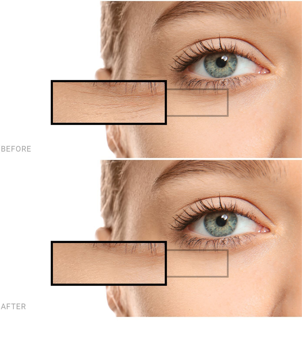 Saffee Advanced Hyaluronic Acid Ampoules - ампулы - 7-дневная интенсивная терапия с гиалуроновой кислотой /   7x2  ml  / GTIN 3760275382887