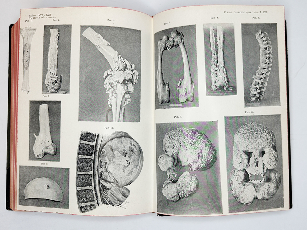 Eulenburg A., проф. Эйленбург А  Реальная энциклопедия практической медицины в XVII томах. 1909-1915