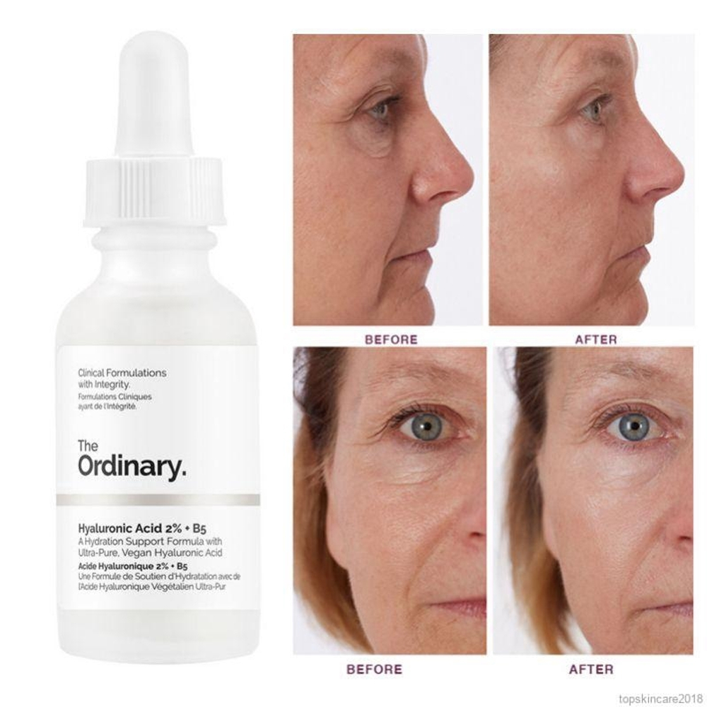 Ordinary hyaluronic acid serum discount