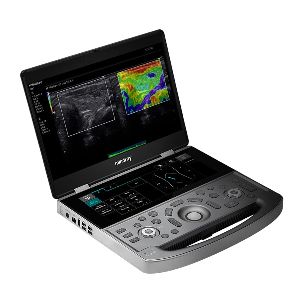 Портативный УЗИ аппарат Mindray MX8 Exp