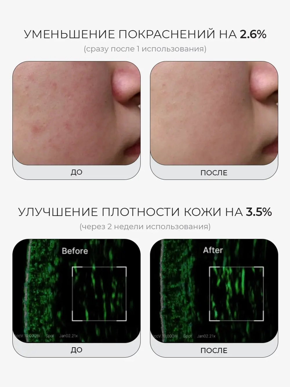 Medicube Укрепляющая сыворотка с ПДРН и пептидами PDRN Pink Peptide Serum 30 мл