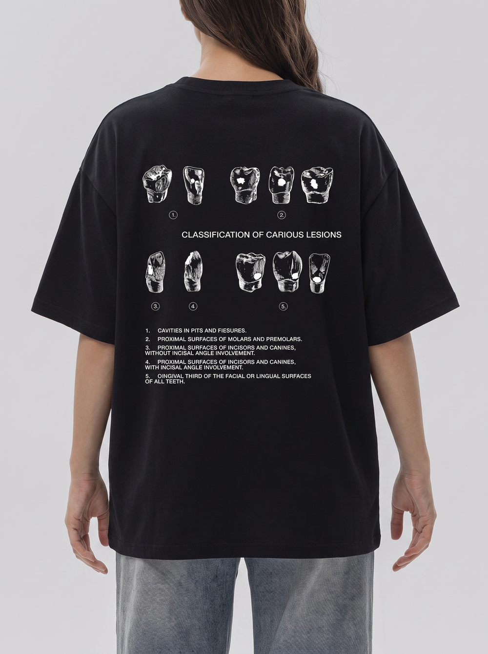Футболка женская Classification of caries