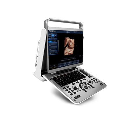 УЗИ аппарат CHISON EBit 30