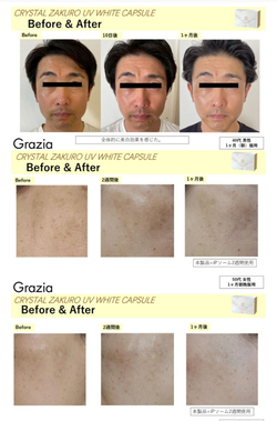 Комплекс для UV-защиты и отбеливания кожи,  профилактики фотостарения DIREIA CRYSTAL ZAKURO UV WHITE CAPSULE , 30 шт.