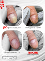 Restore Gel - гипоаллергенный гель для реставрации и протезирования (13 гр)