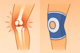 Что делать при нестабильности надколенника и подвывихе чашечки