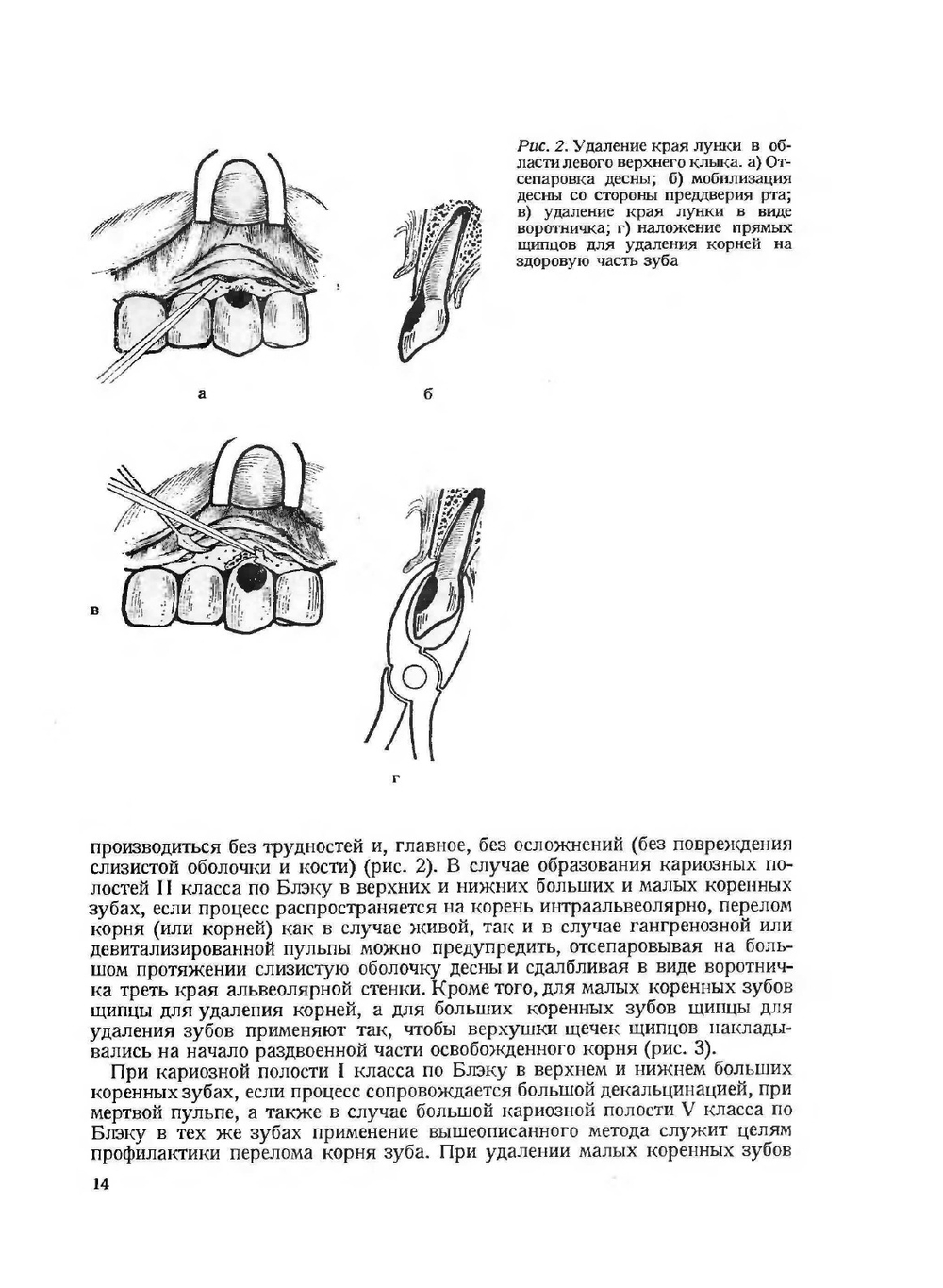Амбулаторная хирургия зубов и полости рта | Е. Сабо