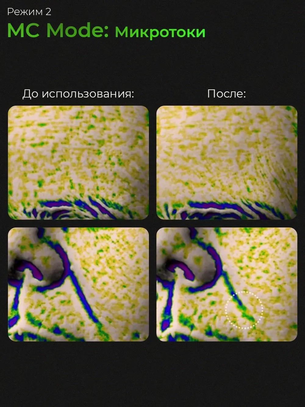 Medicube Микротоковый аппарат для лица 6-в-1 AGE-R Booster Pro Black