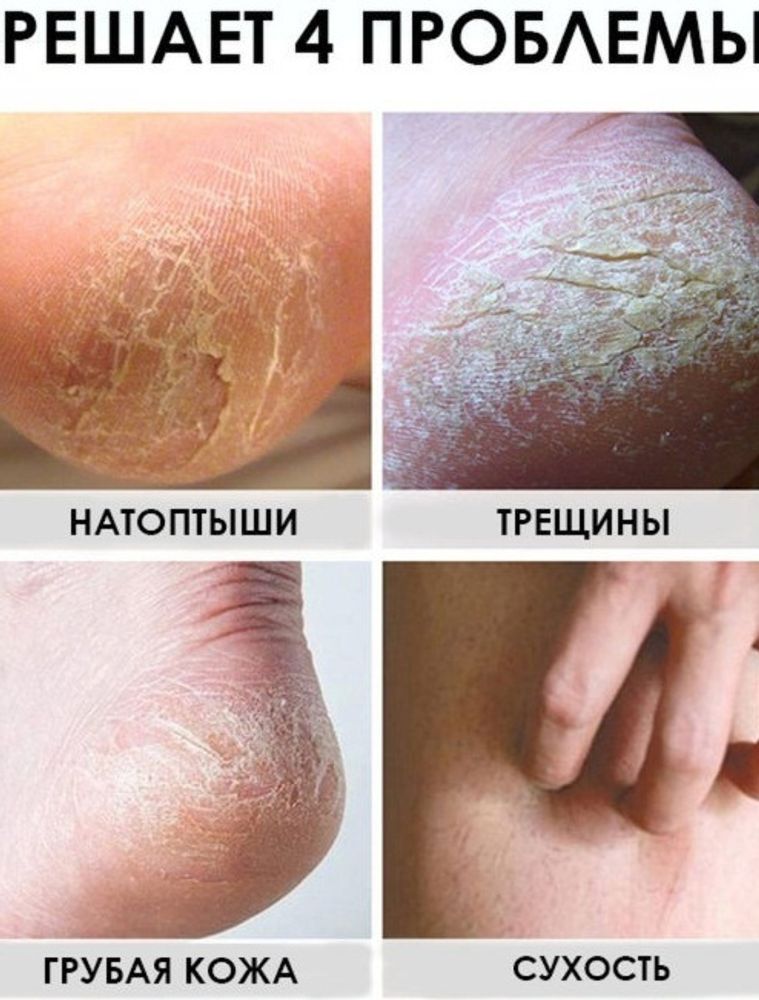 Крем для ног Aichun Beauty, 100 мл