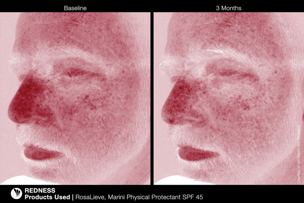 JAN MARINI PHYSICAL PROTECTANT SPF45 (TINTED) Солнцезащитный крем с тональным эффектом с SPF 45