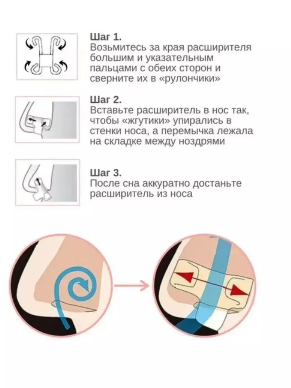 Мини-расширитель для носа от храпа при затрудненном носовом дыхании, 1 шт.