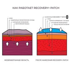 Кинезиотейп KT TAPE Recovery Patch, Аппликация для снятия отеков и воспалений, преднарезанный, 4 шт