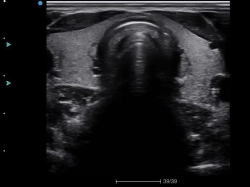 Аппарат УЗИ SIUI Apogee 5800