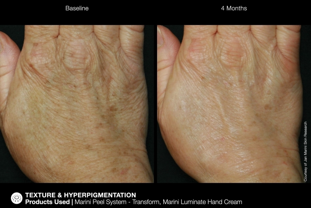 JAN MARINI RENU CORRECTIVE HAND COMPLEX Антивозрастной корректирующий крем для рук