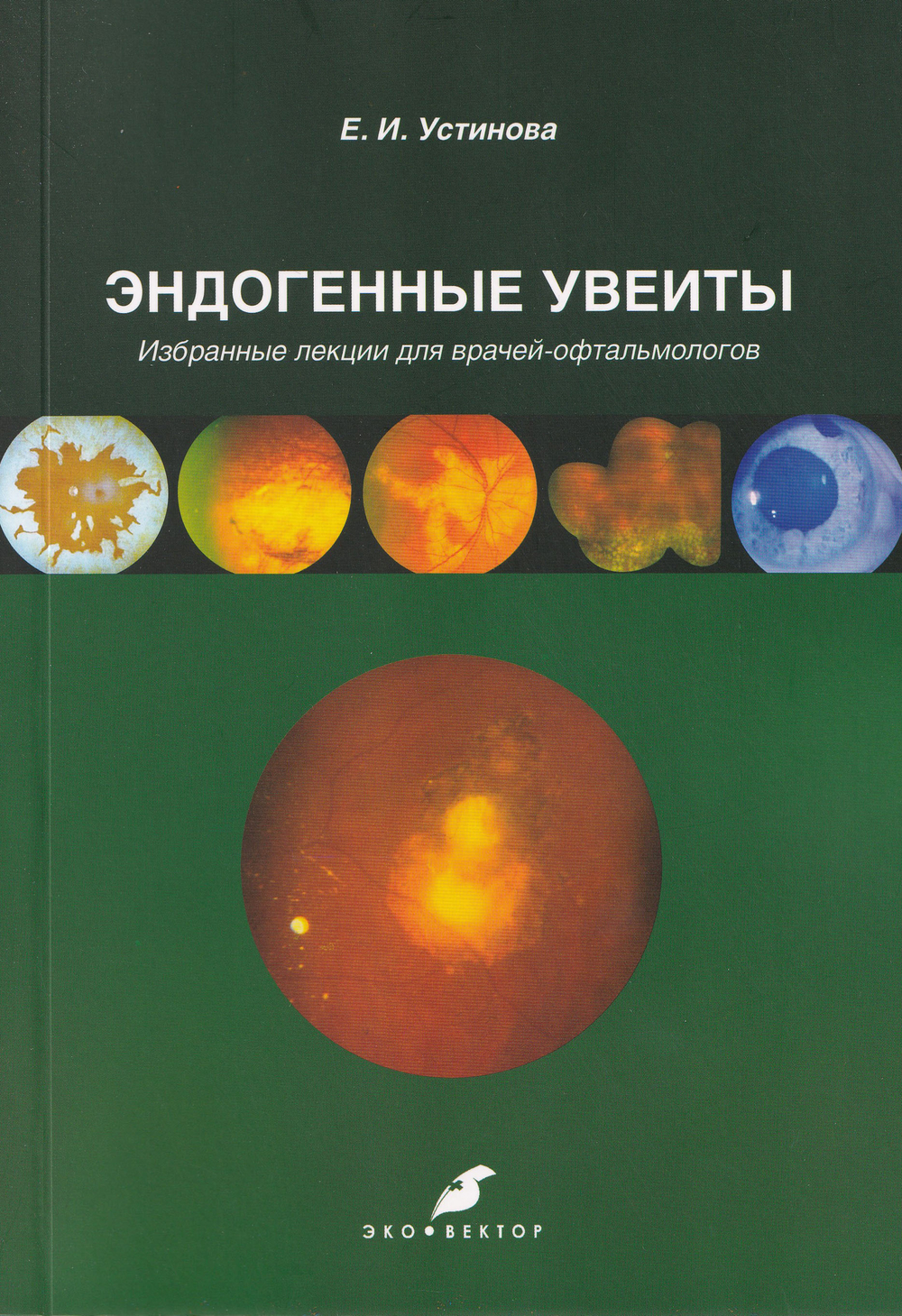 Эндогенные увеиты