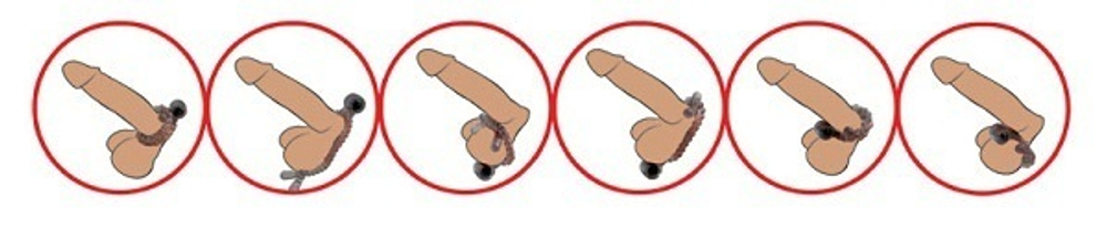 Эрекционное лассо с вибрацией