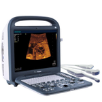 УЗИ аппарат SonoScape S2