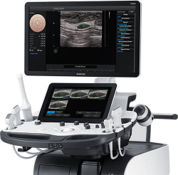 Аппарат УЗИ (сканер) Samsung Medison W10