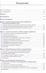 Эндогенные увеиты