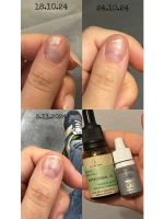 Капли «Сила Серебра» ANTIFUNGAL 250 ppm 5 мл