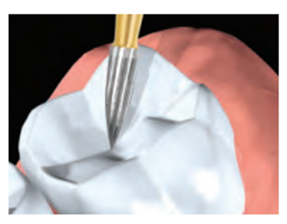 Бор твердосплавный Midwest - 424 FG 7901 T&F
