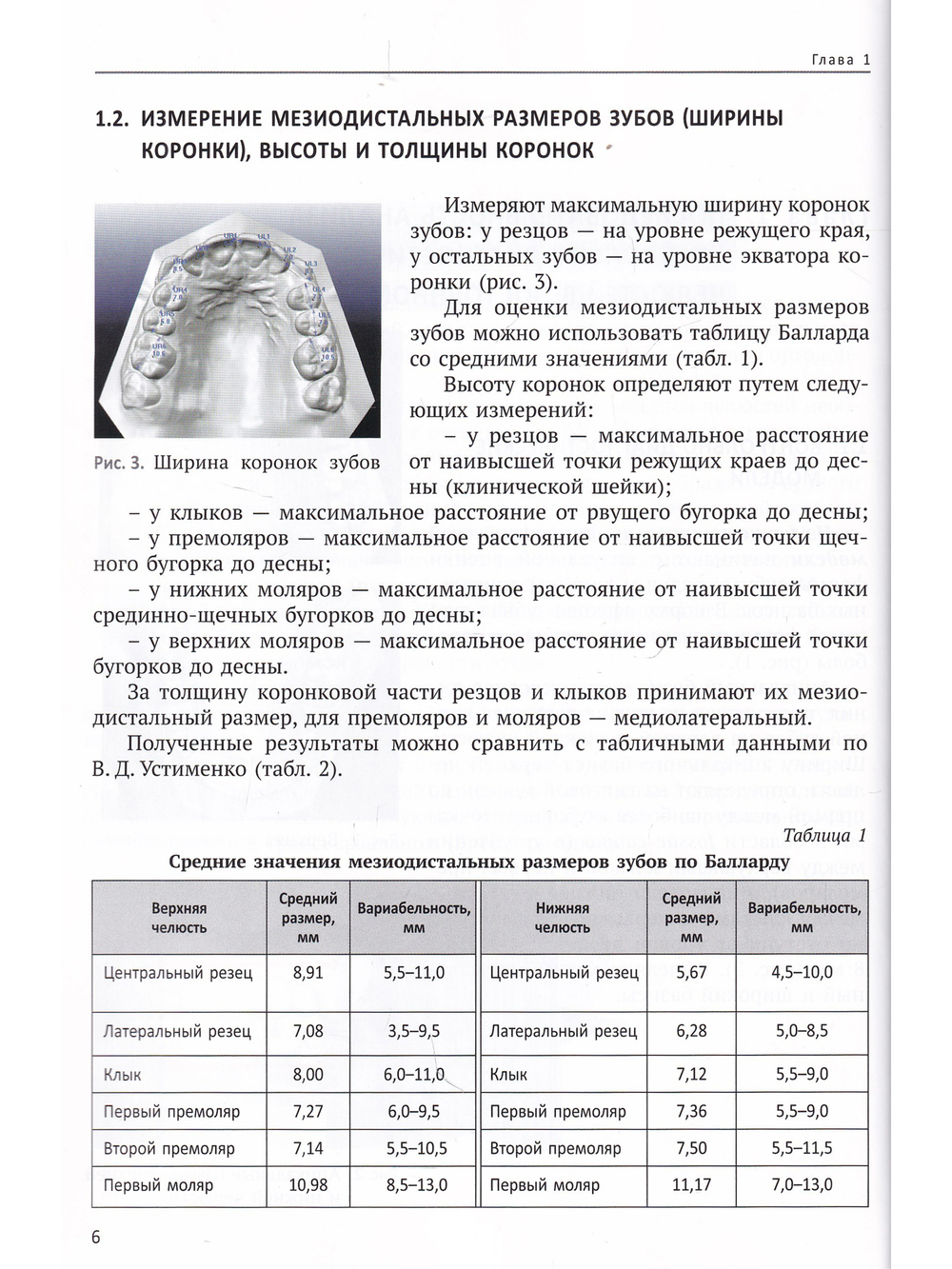 Анализ диагностических моделей челюстей