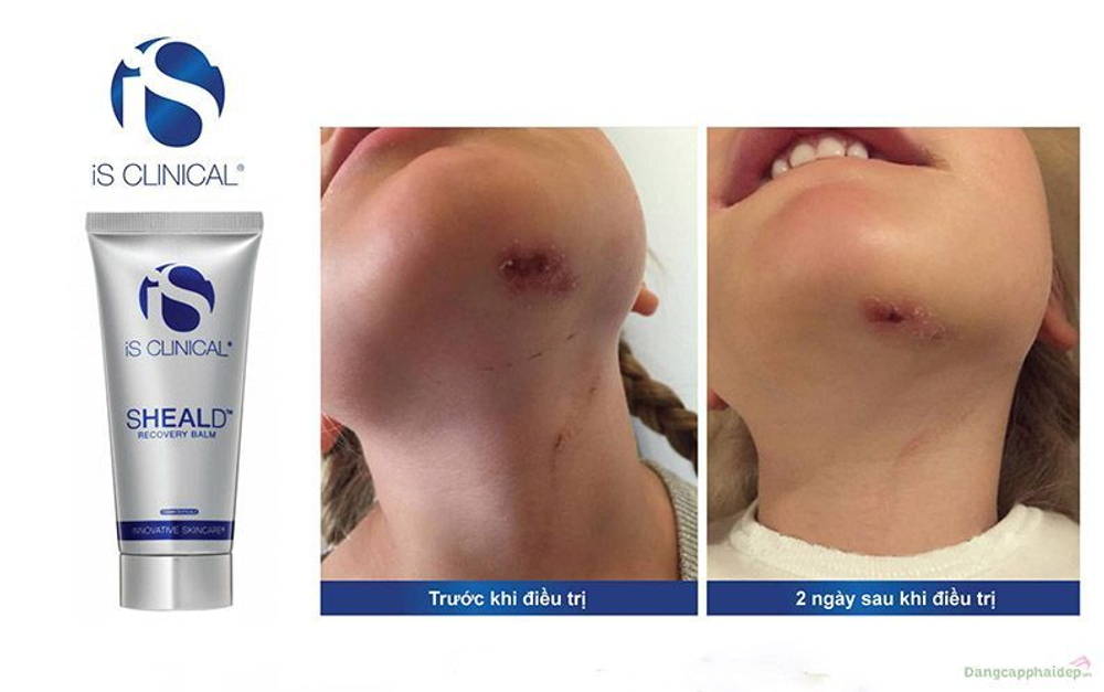 Is clinical SHEALD™ Recovery Balm 15 мл Бальзам защитный восстанавливающий -