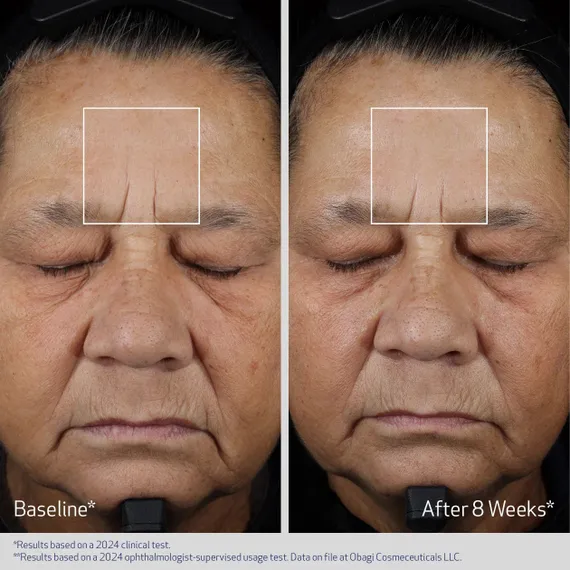 Гель-концентрат от морщин