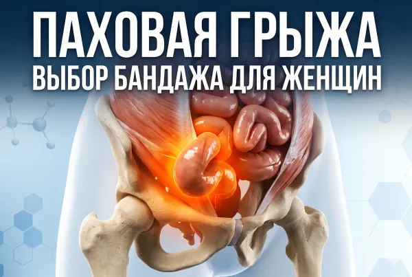 Паховая грыжа у женщин: как распознать и какой бандаж поможет до операции. Паховая грыжа у женщин: как распознать и какой бандаж поможет до операции.