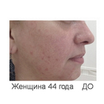 Skin-OX | Осветление | ГК+Аминокислоты+Вит.C