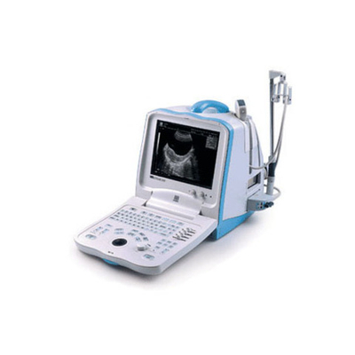 УЗИ аппарат Mindray DP 3300