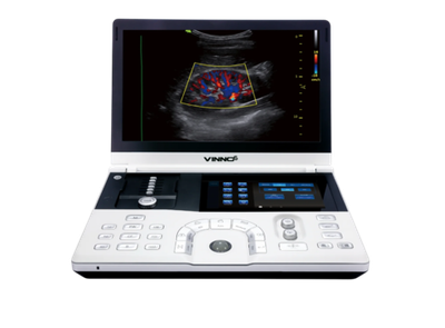 Портативный УЗИ аппарат VINNO 6