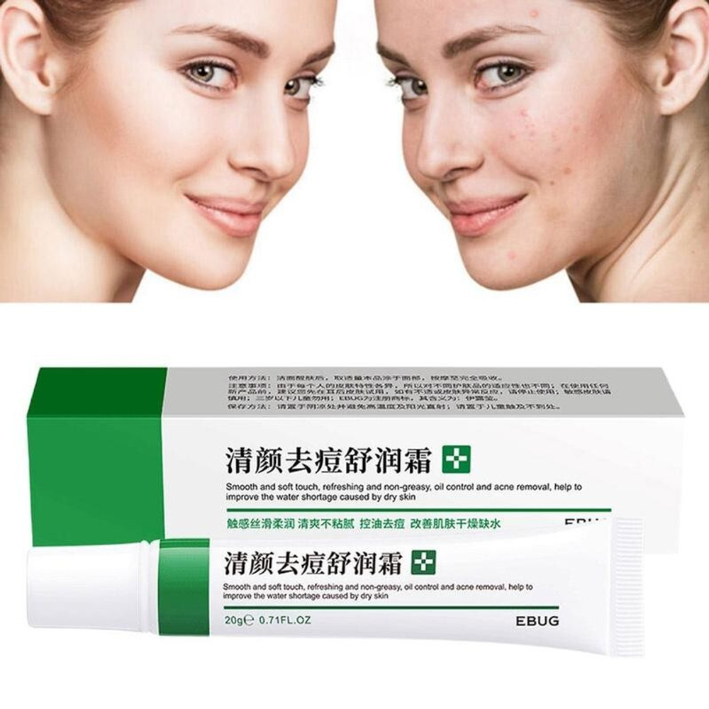 Крем для лица ETAE Moisturize anti-acne cream анти-акне 20 г