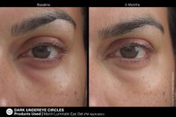 JAN MARINI LUMINATE EYE GEL Концентрированная сыворотка для кожи вокруг глаз с эффектом сияния против темных кругов и морщин