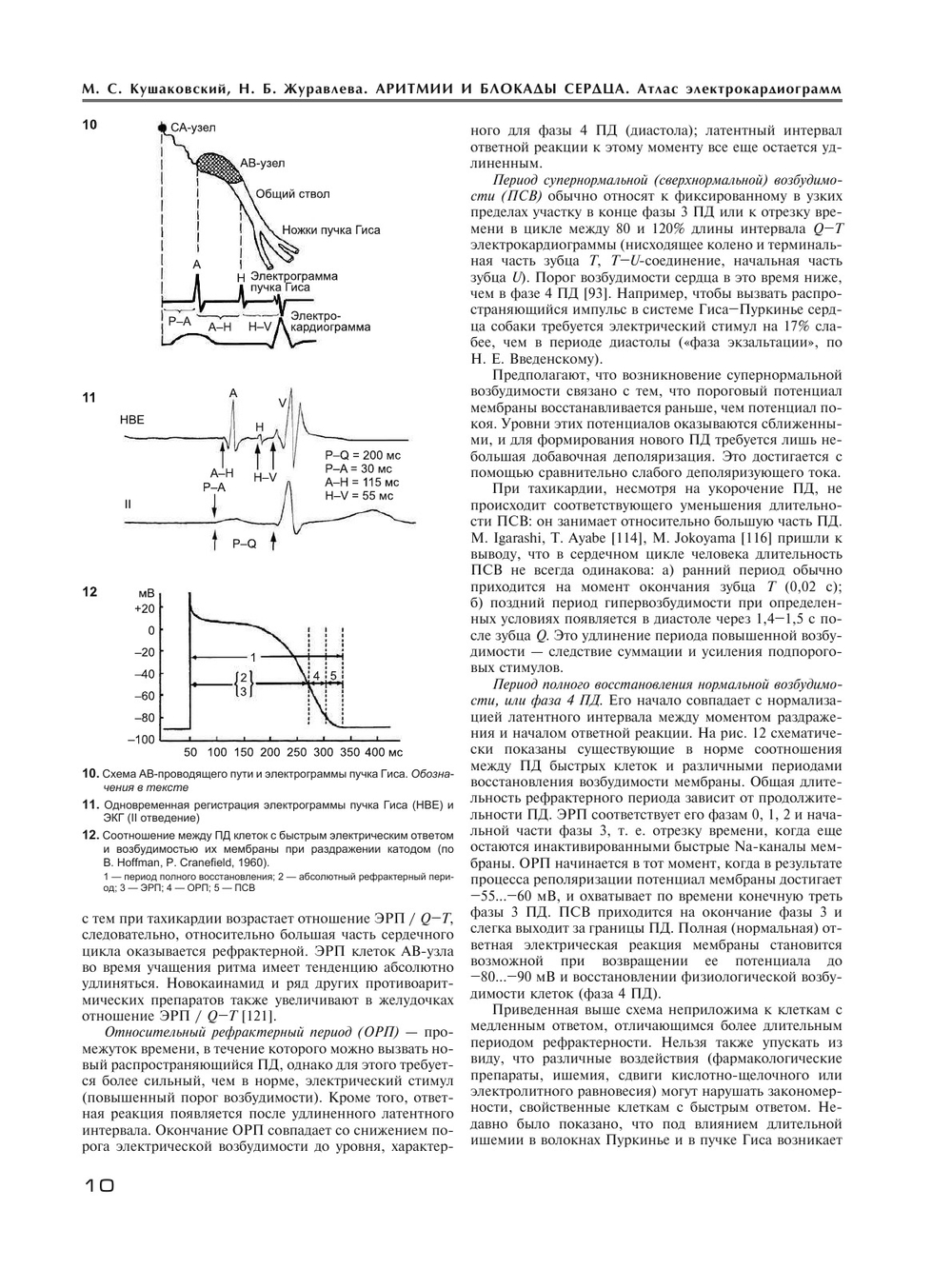 Аритмии и блокады сердца. Атлас электрокардиограмм | М.С. Кушаковский