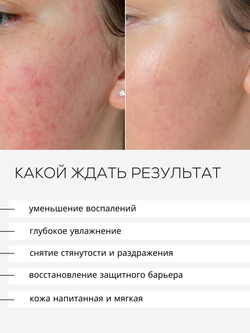 СЫВОРОТКА ДЛЯ ЧУВСТВИТЕЛЬНОЙ И РЕАКТИВНОЙ КОЖИ